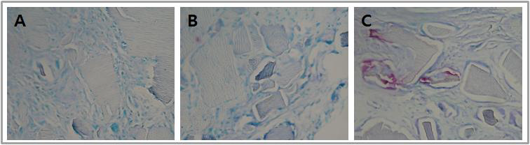 TRAP staining. DDP(A), RAD-DDP(B) and RGD-DDP(C).