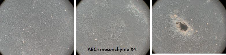 ABC와 중간엽세포의 공배양을 통한 미네랄형성