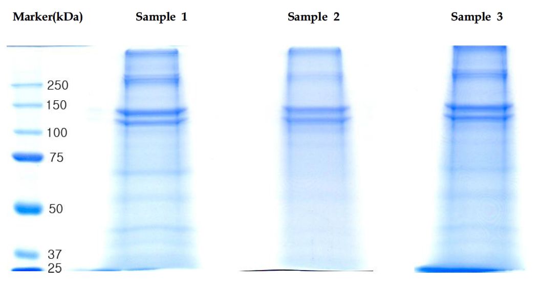 SDS-PAGE analysis of human dentin-extract.