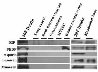 Validation of protein expression in human various cell line by western blot analysis.