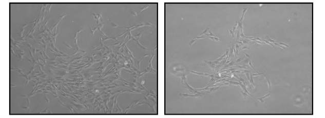 Colony-forming cells from dental pulp tissue after 8 days