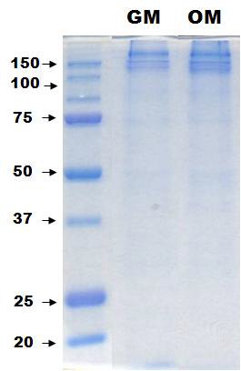 SDS-PAGE analysis of protein in the secretome of hDPSCs