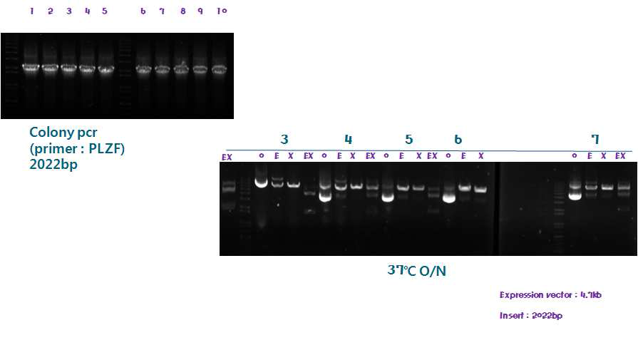 Expression vector에 insert 삽입 후, colony PCR 및 제한효소 처리