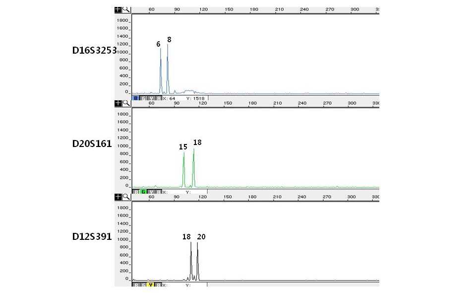 Electropherograms of miniSTR multiplex system III