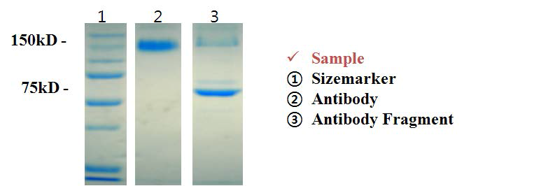 전기영동을 이용한 항체 절편 확인