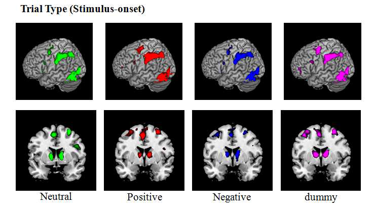 feedback유형별 학습 조건에서의 자극제시로 인한 두뇌 활성화 영역