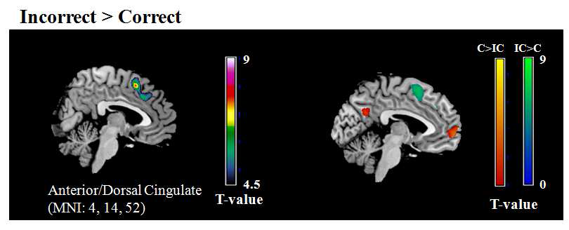 정반응에 비하여 오반응 feedback이 더 높은 활성화를 보이 는 두뇌 영역(좌측). 정반응이 더 높은 활성화를 보이는 영역(적색)과 오반응이 더 높은 활성화를 보이는 영역(녹색)을 표시(우측)