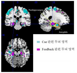 3session에서 높은 활성화 를 보이는 영역임. 학습의 자극 단서 에 대한 변화를 보이는 영역은 blue, feedback에 대한 시간적 변화를 부이 는 영역은 violet으로 표시. 대부분의 두뇌 영역은 젓복되지 않음