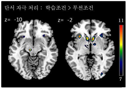 무선조건에 비해 학습조건에서 높은 활성화를 보이는 두뇌 영역