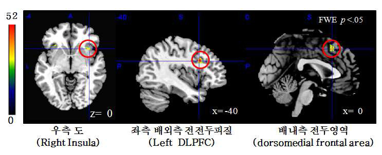 학습조건의 처벌피드백에서만 변별적인 반응을 보이는 두 뇌 영역