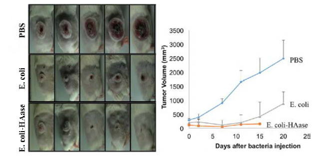 Hyaluronidase 탑재 무독성 박테리아의 종양억제능 확인