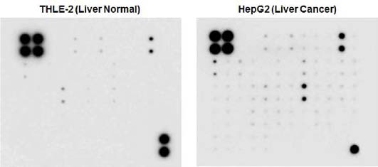 M i c r o a r r a y 를 이용한 정상 간세포와 간암세포 간의 단백질 신호 비교분석