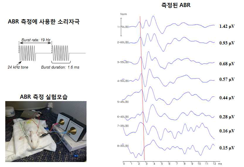 ABR 측정에 사용한 소리자극의 파라미터와 실험모습, 측정된 ABR 파형