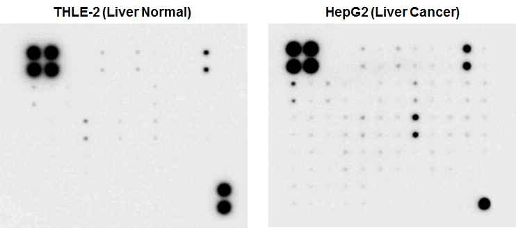 Microarray를 이용한 정상 간세포와 간암세포 간의 단백질 신호 비교 분석