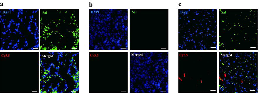 Tumor bearing mouse에 살모넬라가 부착된 마이크로비드를 투입한 암조직 (녹색-살모넬라, 적색-마이크로비드)