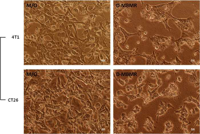 단핵구 기반 박테리오봇의 암세포 사멸능 확인 (M/O; monocyte처리군, D-MBMR; 항암제가 담지된 단핵구 기반 박테리오봇)