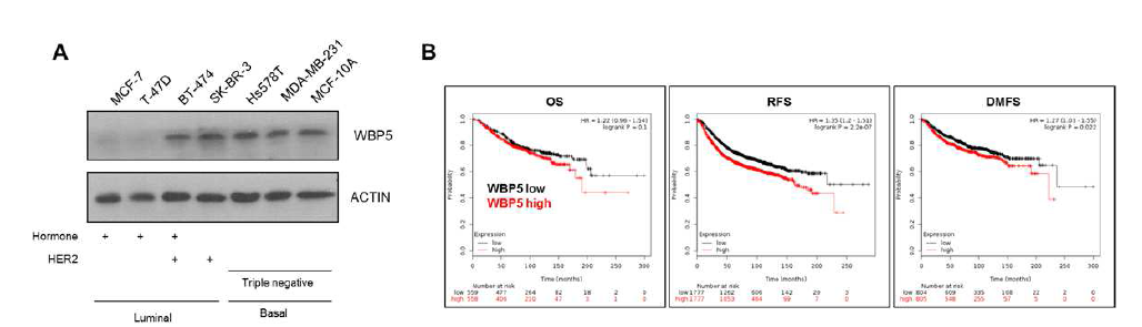 WBP5의 유방암 세포주내 발현 양상 및 WBP5 발현에 따른 유방암 환자의 생존율 분석
