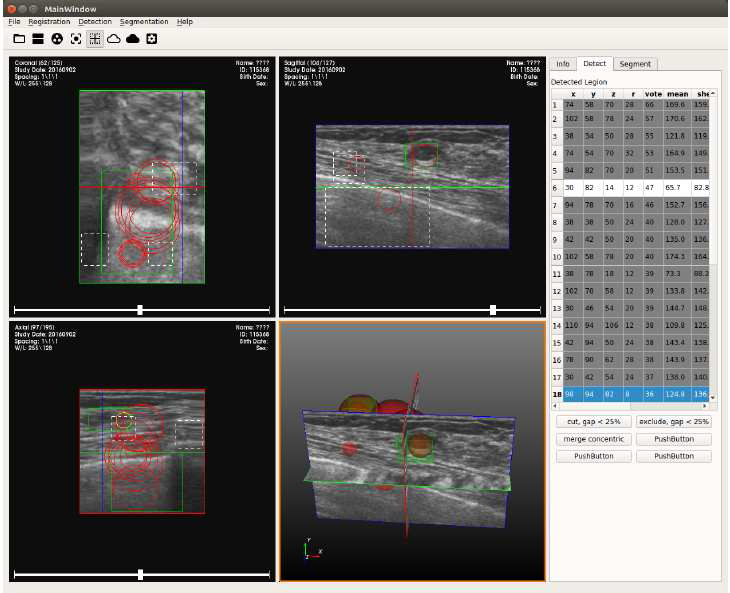 CAD S/W Mass Detection