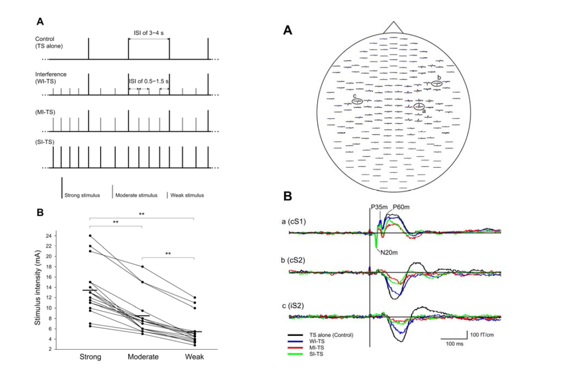 Left. (A) Schematic representation of the experimental paradigm. (B) The individual interfering stimuli with three different levels of stimulus intensities (17 subjects). Right. (A) Spatial distribution of somatosensory evoked magnetic field to left median nerve test stimulus in each experimental condition in a representative subject. (B) The enlarged response recorded from the cS1, cS2, and iS2 regions