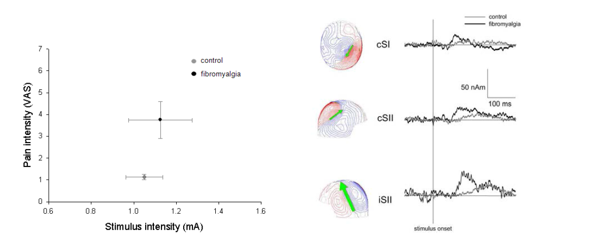 왼쪽. Intraepidermal stimulator를 이용하여 통각(Aδ-fiber) 자극에 대한 pain intensity (VAS)의 수치 정량화. 통각(Aδ-fiber) 자극 후 통증 네트워크에서의 활동성 분석 (오른쪽)