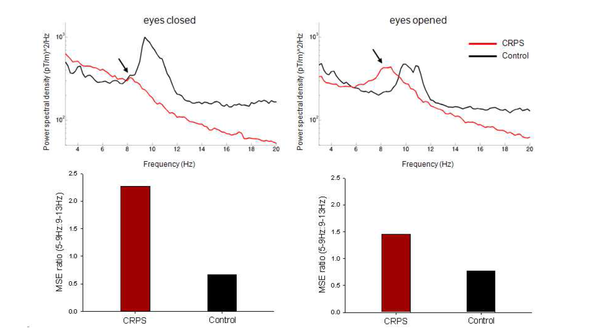 정상대조군과 CRPS의 resting state에서의 spectral power 분석