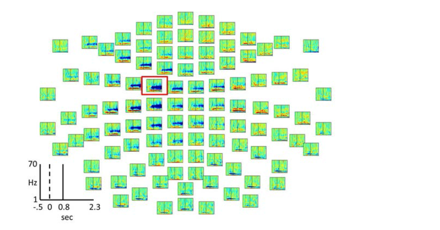 Time-frequency representation for ‘paired’ trials (subject 9)