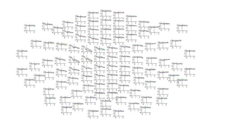 Beta-band ERD for all three sequence categories. Averaged for 26Hz for subject 9