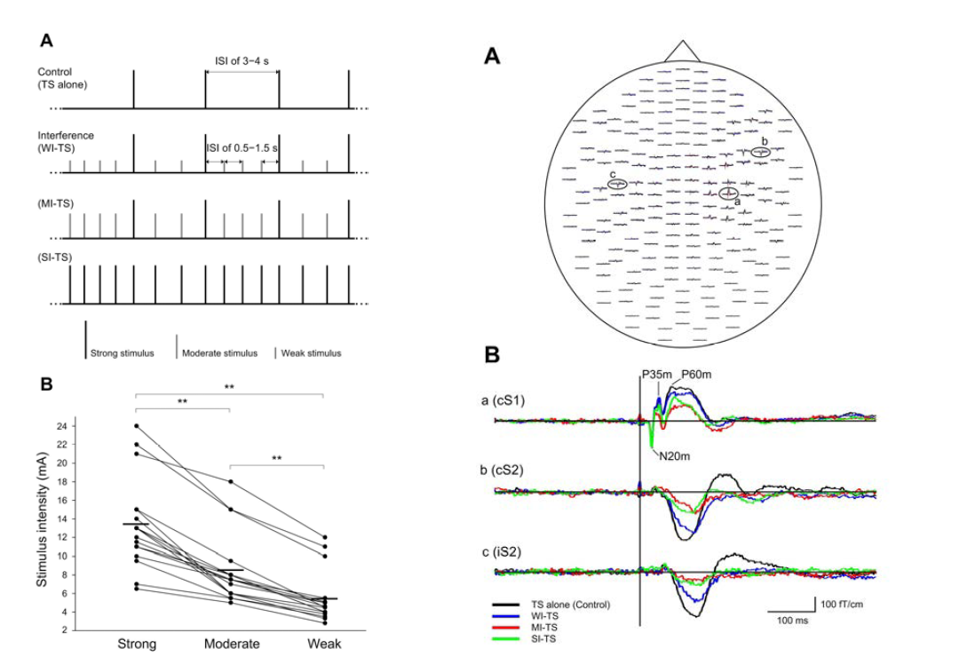 Left. (A) Schematic representation of the experimental paradigm. (B) The individual interfering stimuli with three different levels of stimulus intensities (17 subjects). Right. (A) Spatial distribution of somatosensory evoked magnetic field to left median nerve test stimulus in each experimental condition in a representative subject. (B) The enlarged response recorded from the cS1, cS2, and iS2 regions. The vertical line indicates the stimulus onset.