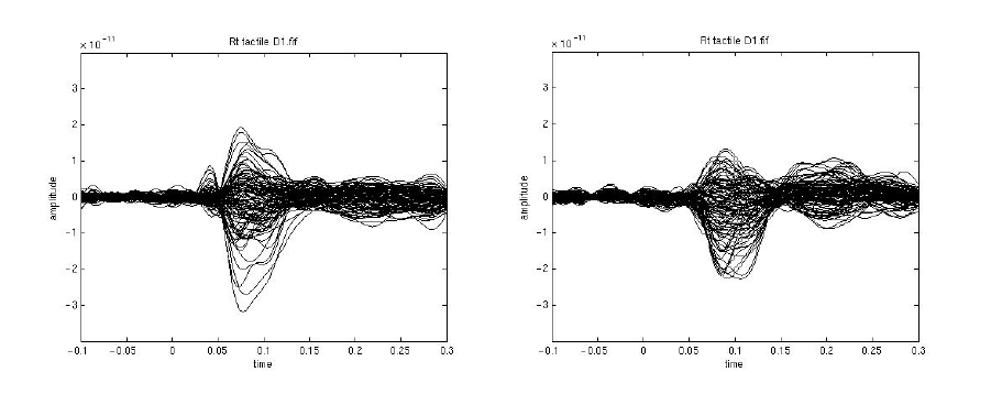 왼쪽. 오른손 엄지손가락 촉각 자극에 대한 contalateral 영역 response의 butterfly plot. 오른쪽. 오른손 엄지손가락 촉각 자극에 대한 ipsilateral 영역 responses