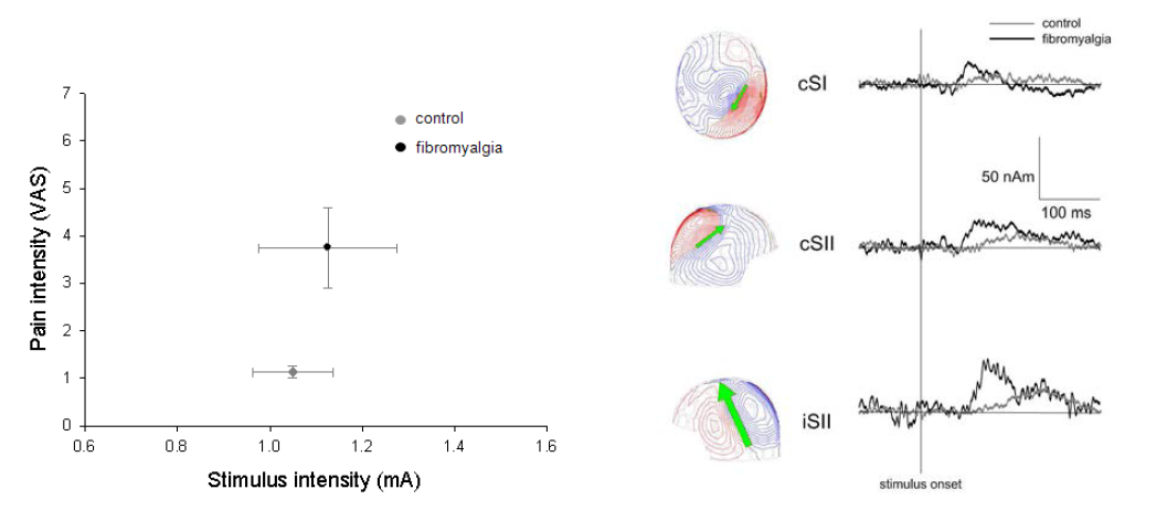 왼쪽. Intraepidermal stimulator를 이용하여 통각(Aδ-fiber) 자극에 대한 pain intensity (VAS)의 수치 정량화. 통각(Aδ-fiber) 자극 후 통증 네트워크에서의 활동성 분석 (오른쪽).