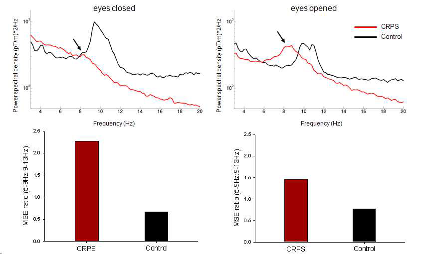 정상대조군과 CRPS의 resting state에서의 spectral power 분석.