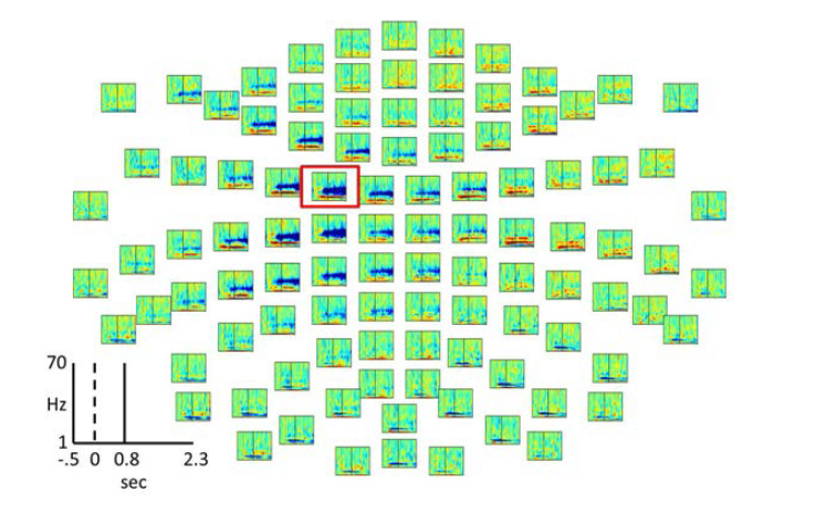 Time-frequency representation for 'paired' trials (subject 9).