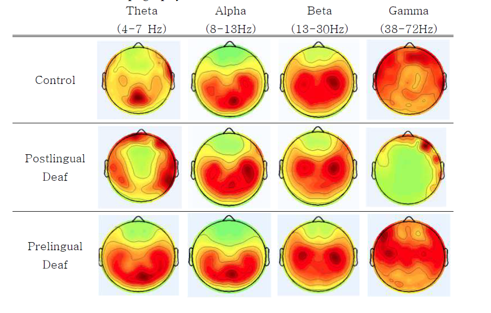 그룹간 EEG 대역별 PSD의 topography 결과