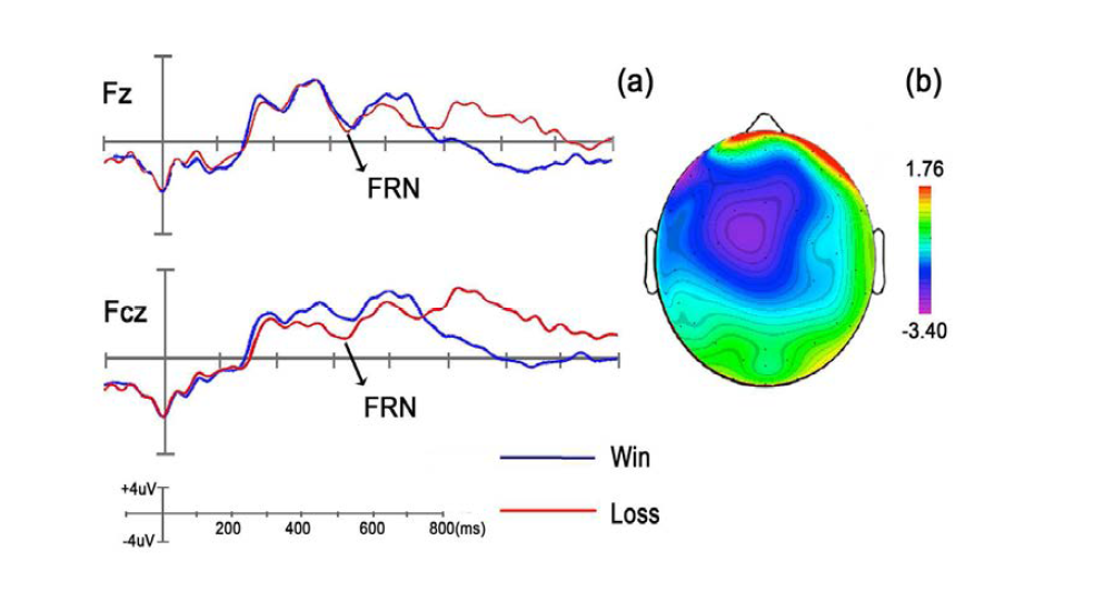 Grand-average ERP(a)와 topography(b)