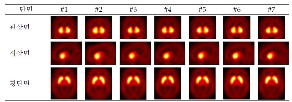 정상청년 피험자 7명(#1-7)의 F-18-fallypride PET을 공간정규화 및 편평화 처리한 결과