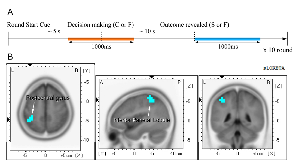 (A) 반복적 공공재 게임 중 일회 동안의 실험 진행 모식도. 주황색: 의사결정 구획, 파란색: 결과 반응 구획 (B) sLORETA 프로그램상에서 수행한 통계적 비모수적 매핑을 이용하여 여성피험자 중에서 협동하였으나 실패한 경우에 대해 탐사보고를 보기 전과 후의 차이를 비교함.