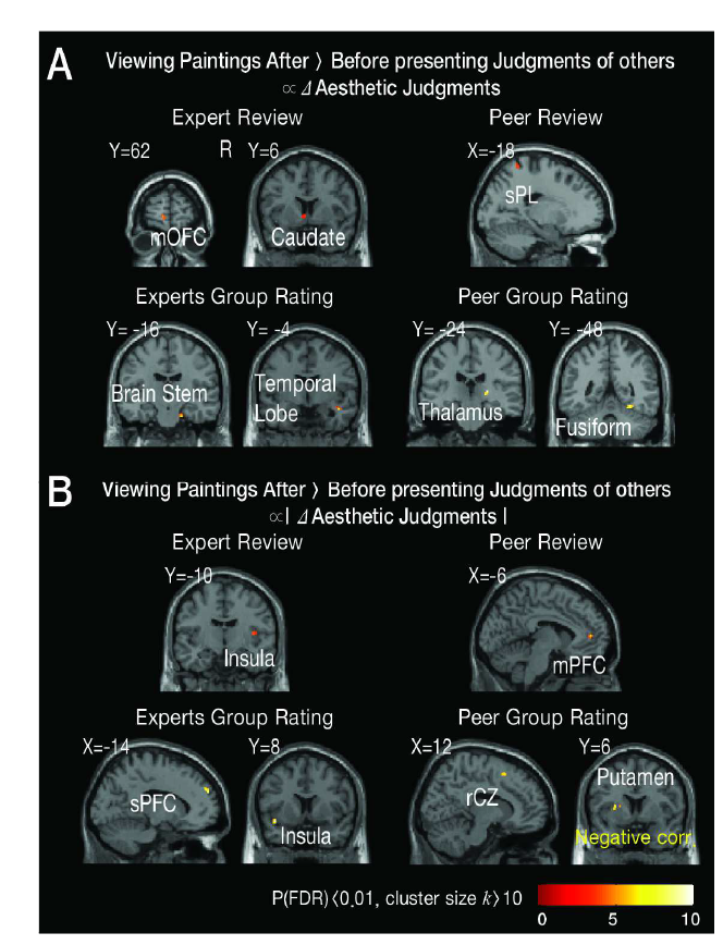 타임의 미적 평가에 따라 변화하는 피험자의 미적 판단의 정도와 유의미한 상관관계의 활성 정도를 보이는 뇌 영역