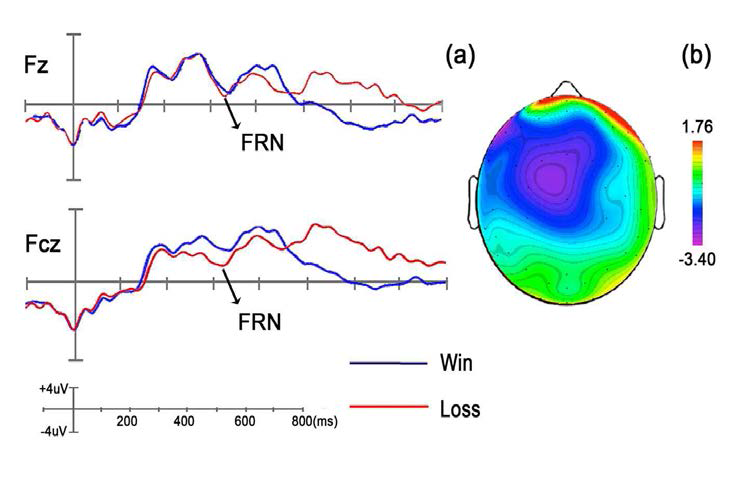 Grand-average ERP(a)와 topography(b)