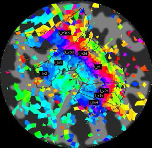 새로 설치한 fRMI장비로 얻은 retinotopy map