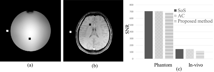 Phantom과 In-vivo SNR 비교 결과