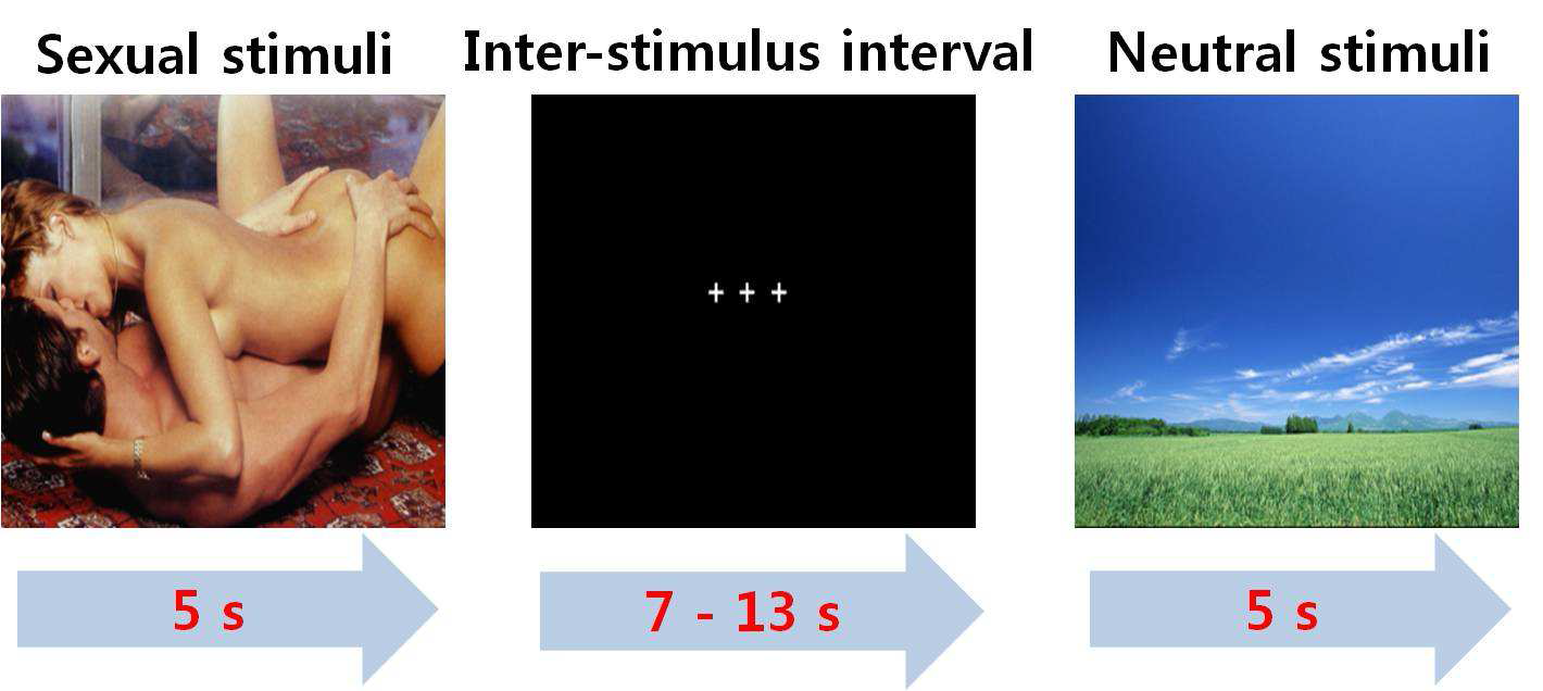 성적 갈망 및 흥분 유발 자극 패러다임