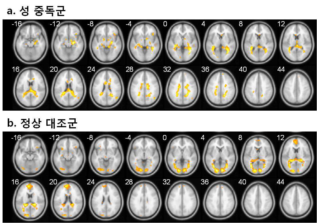 중성자극을 보다 성적 자극 제시 시 더 활성화된 뇌 영역