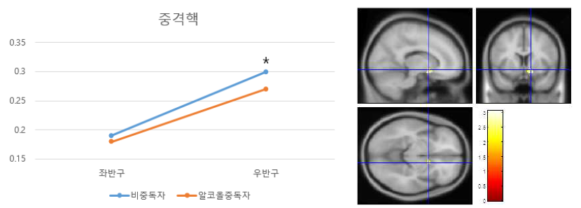 중격핵에서 알코올 중독자의 체적 감소. (*p<.05)