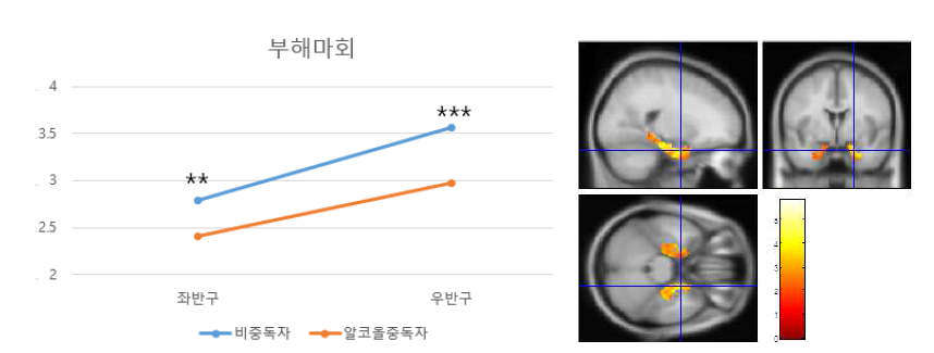 부해마회에서 알코올 중독자의 체적 감소. (**p<.01,***p<.001)