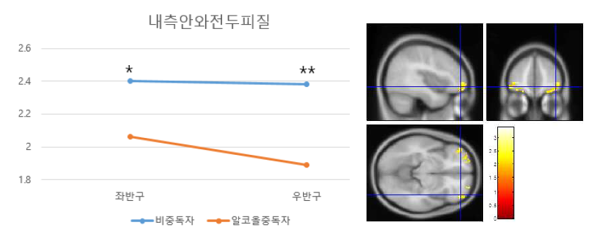 내측안와전두피질에서 알코올 중독자의 체적 감소 .(*p<.05,**p<.01)