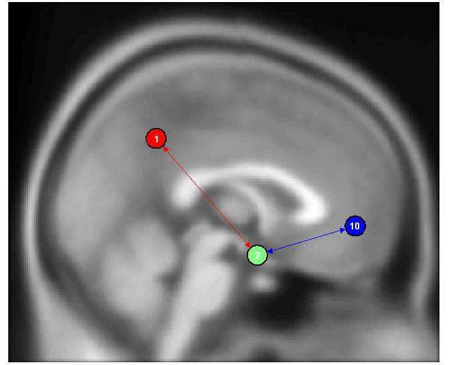 정상 대조군과 성 중독군의 기능적 연결성이 차이가 나는 뇌 영역