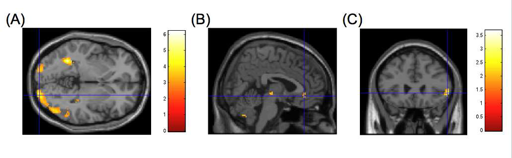 The locations of (A) the visual cortex, (B) anterior cingulate cortex and (C) ventro-lateral prefrontal cortex as regions of interest for dynamic causal modelling.