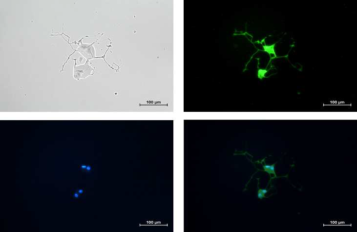 분화된 PC12세포의 광학 및 염색이미지