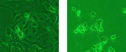 고정화된 신경세포의 미분화 및 분화 이미지