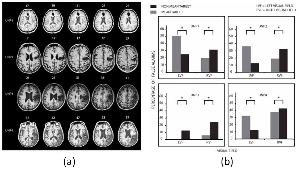 (a) 4명의 무시증 환자 참가자 (b) 시각 탐색 결과